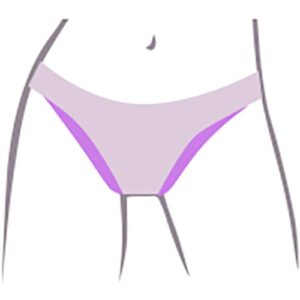 Bikini podstawowe - depilacja laserowa