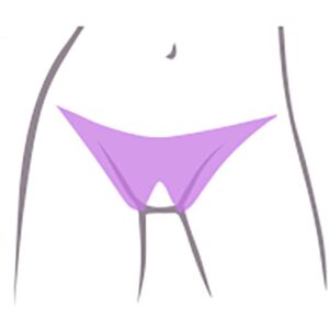 Bikini średnie - depilacja laserowa